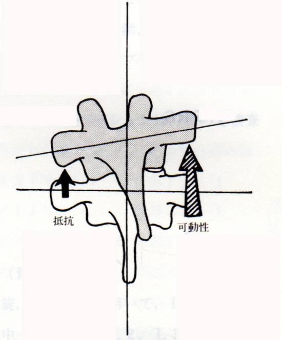 胸椎5番が後方・右回旋・左側屈にズレたのを触診する図の2